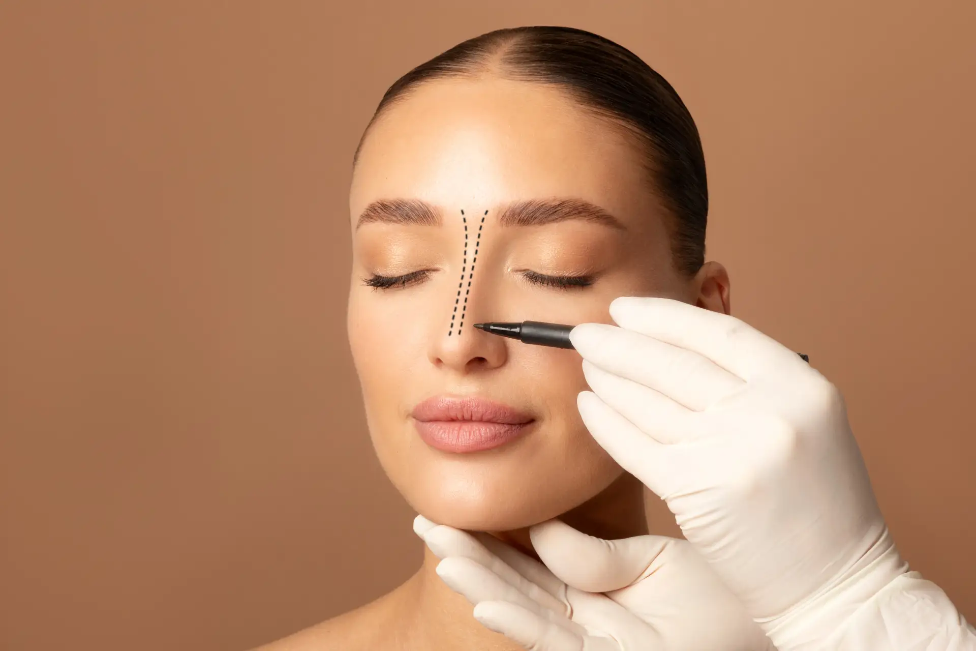 Rhinoplasty-Luneste Clinic