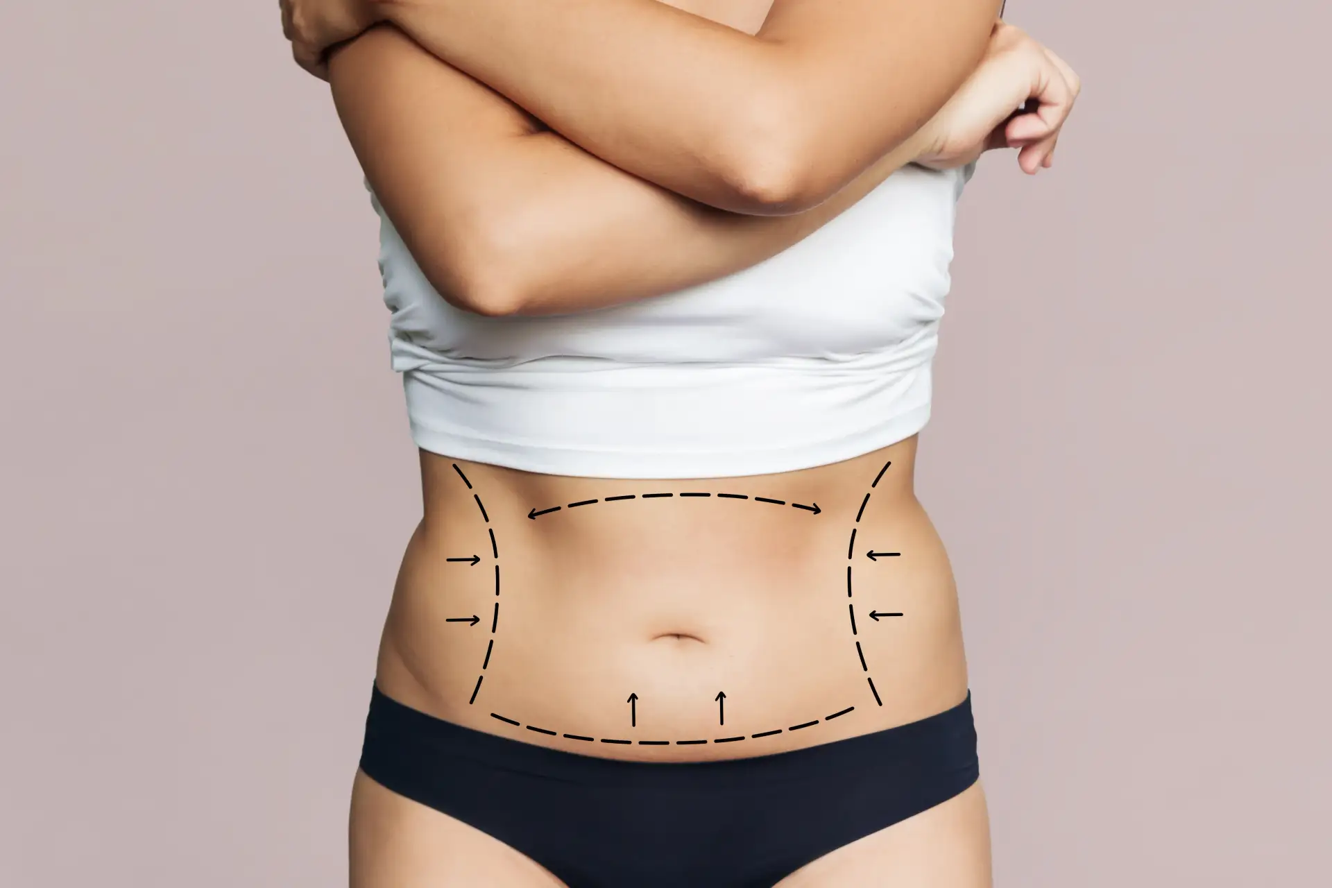 why-choose-our-clinic-liposuction