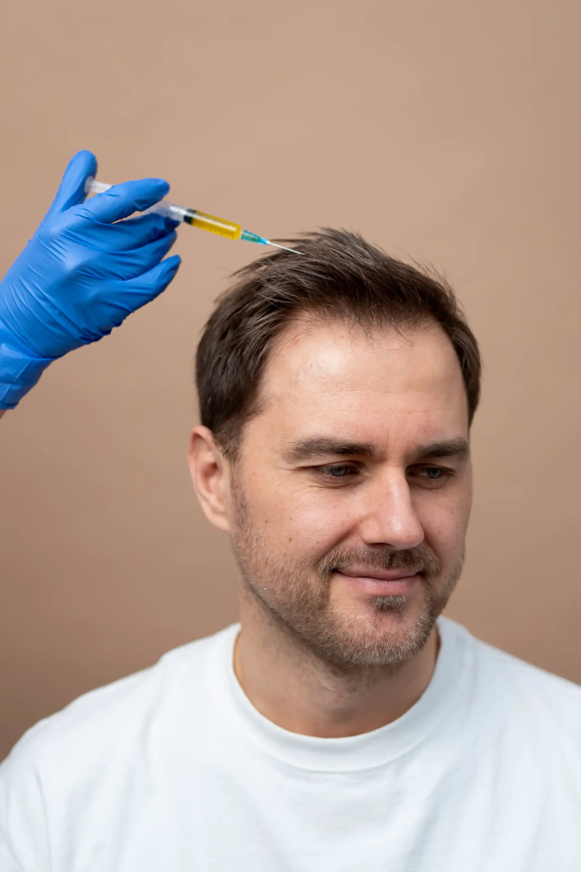what-concerns-can-hair-mesotherapy