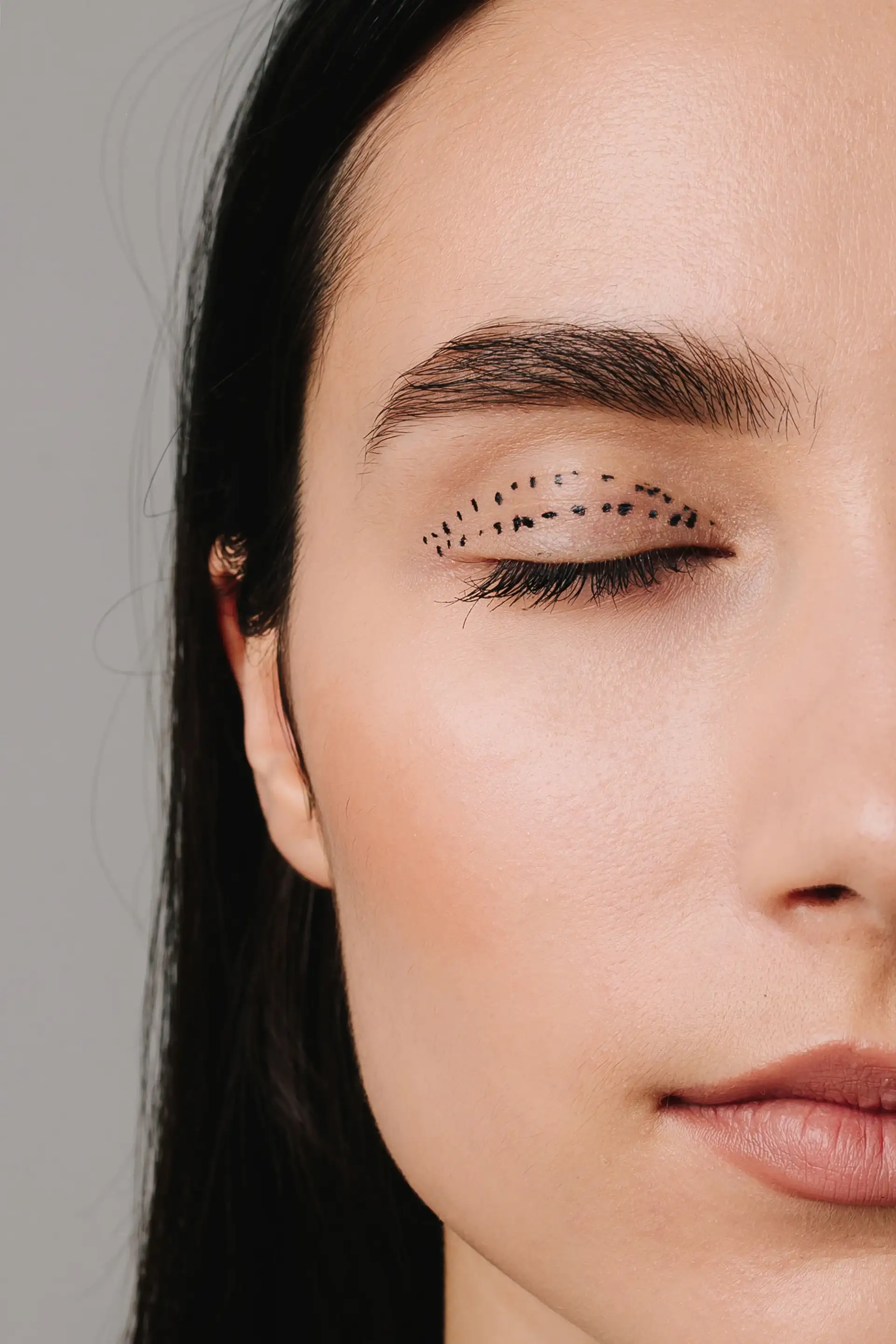 What is Eyelid Surgery (Blepharoplasty)?