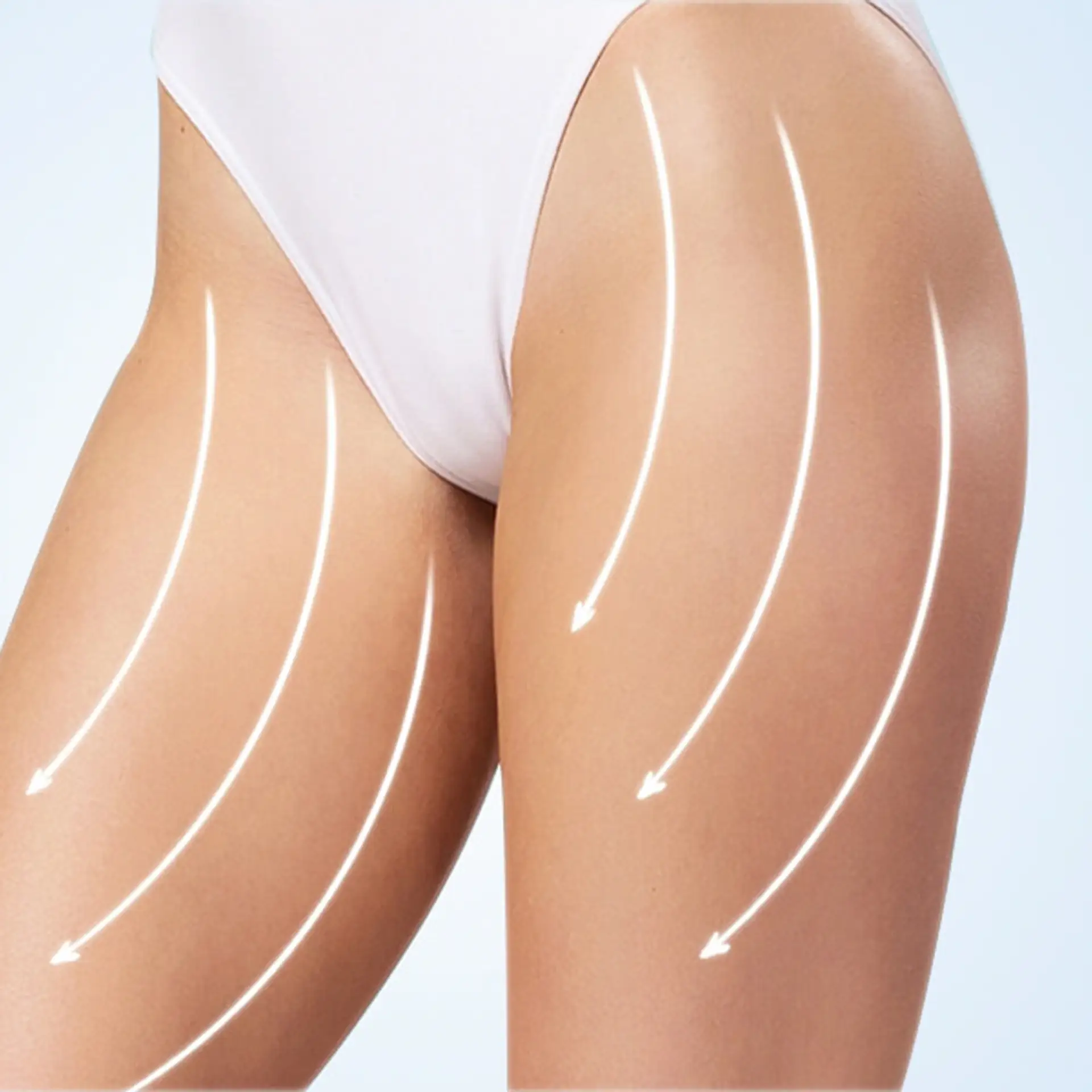 thigh-lift-surgery-work