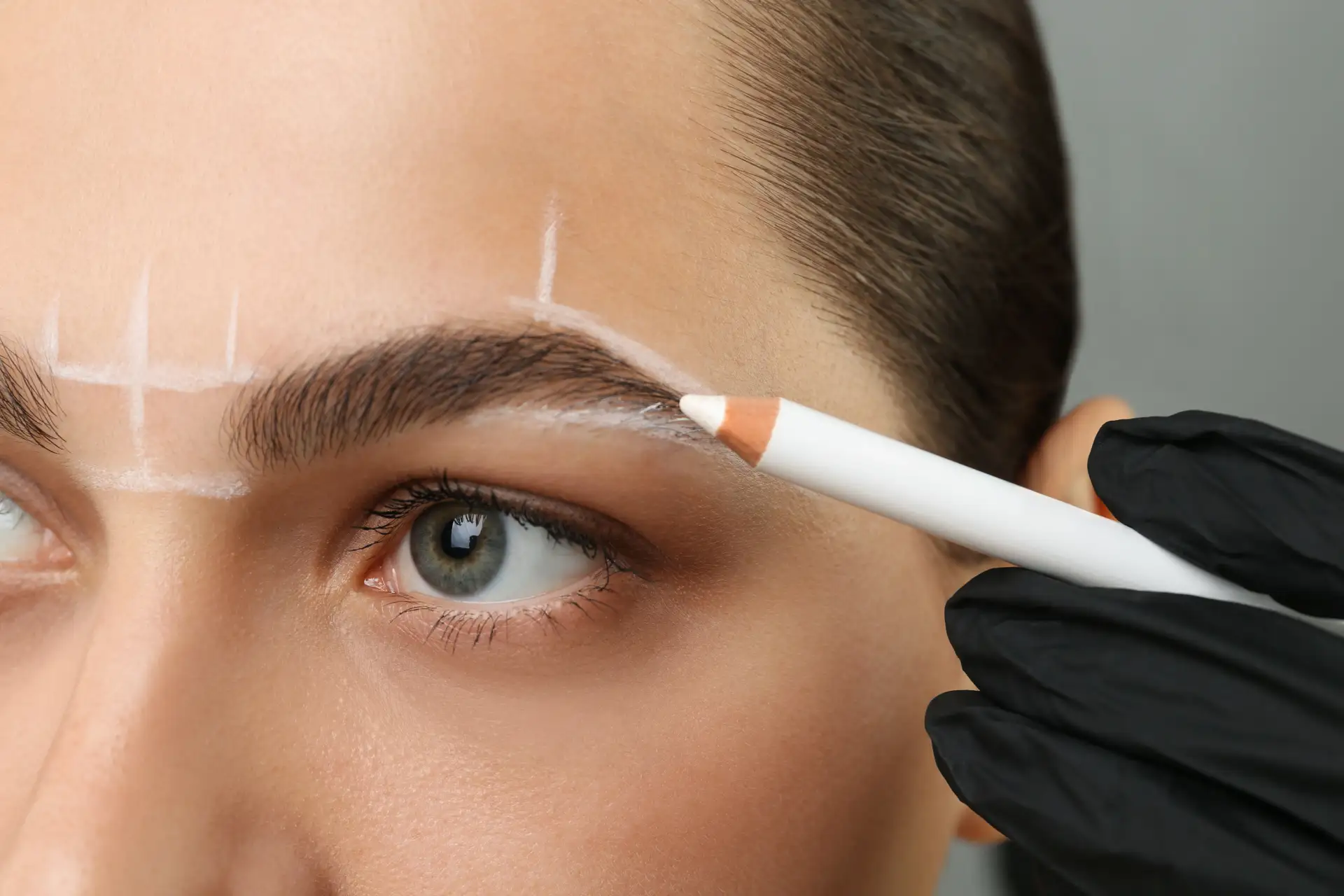 Brow Lift