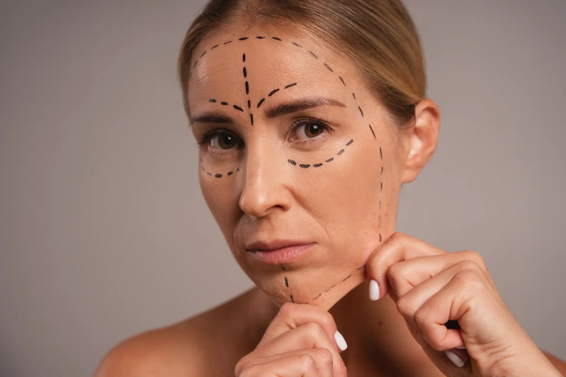 What-is-a-Facelift