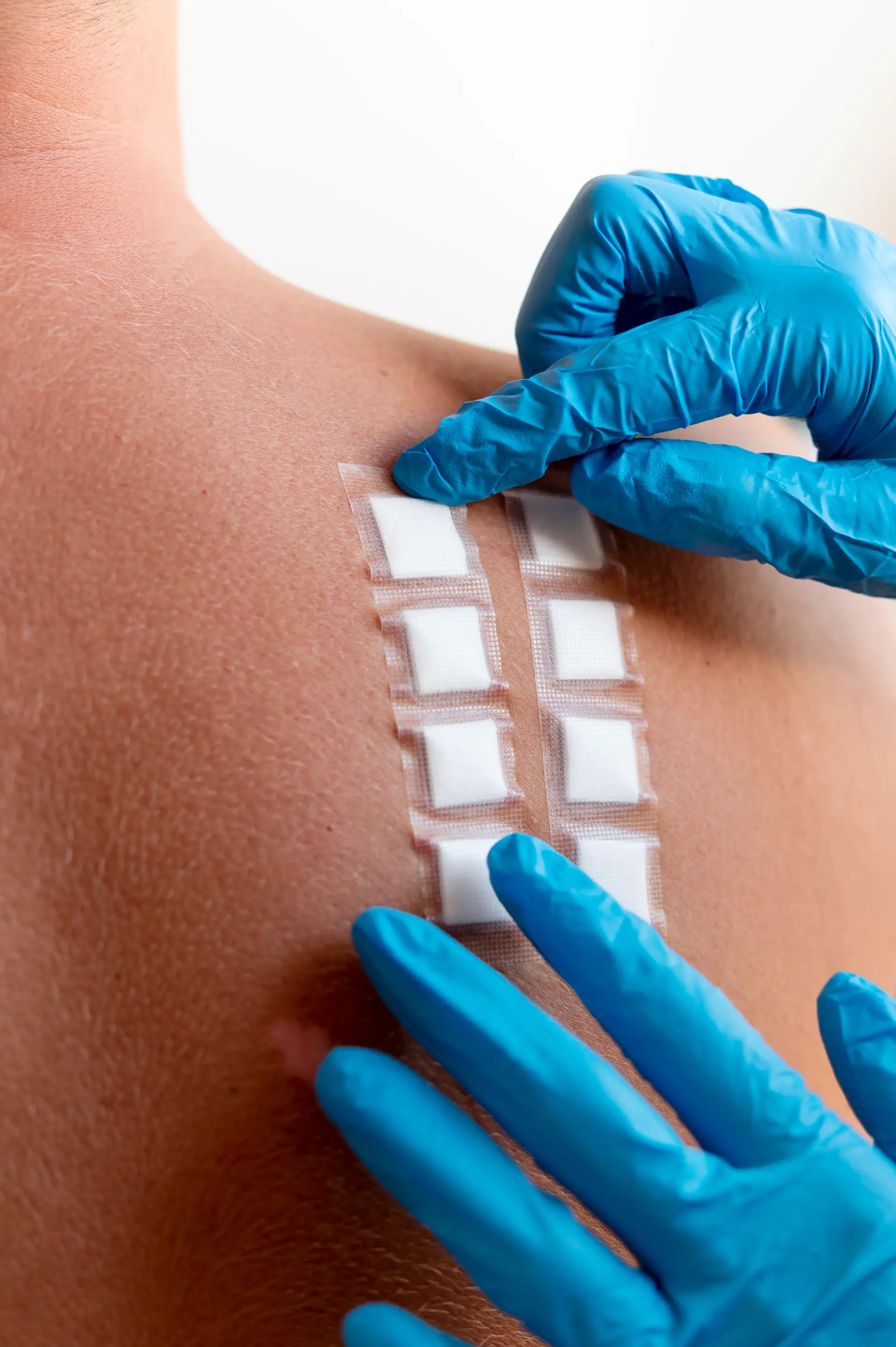 how-does-scar-and-tissue