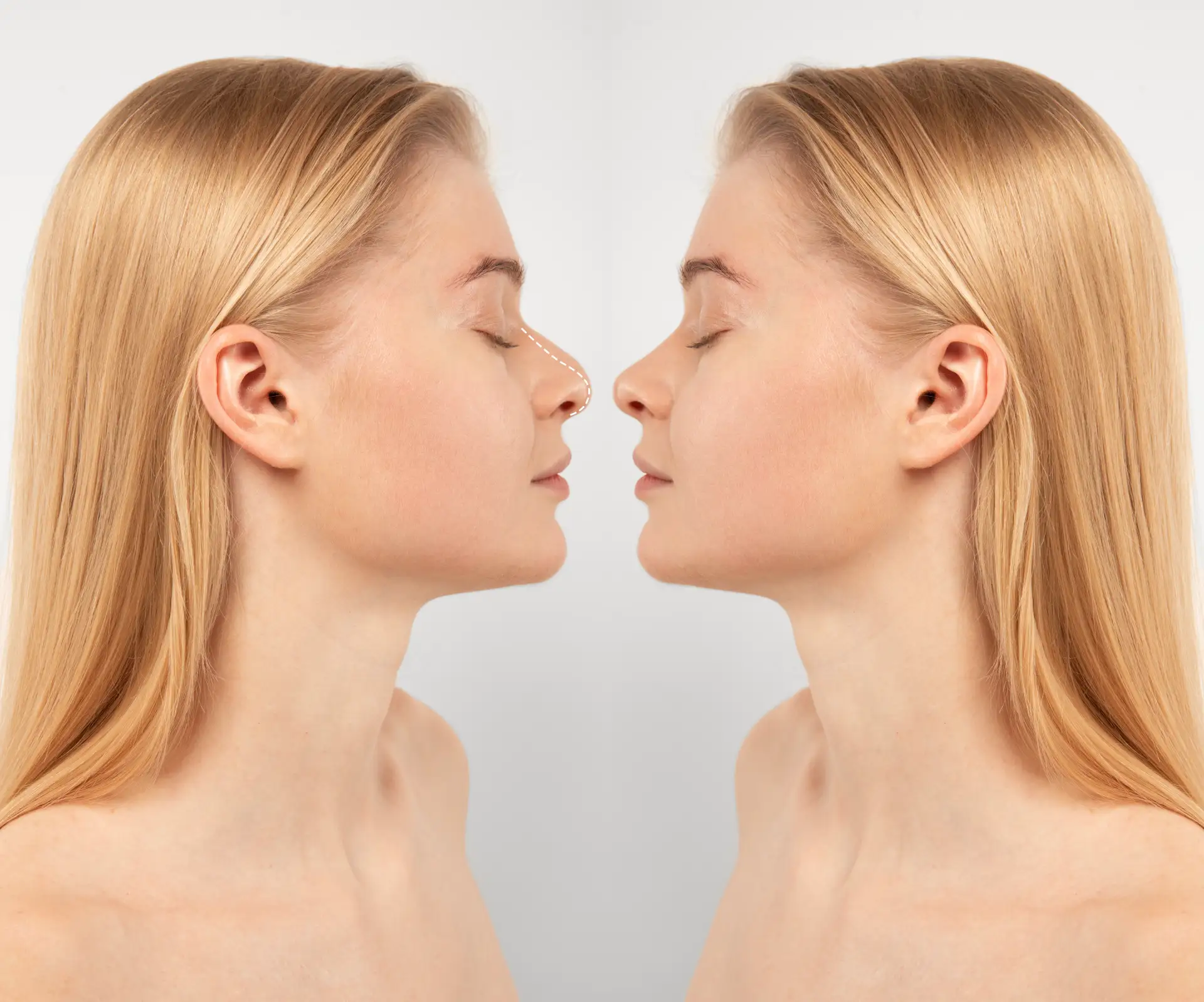 Desire-a-more-natural