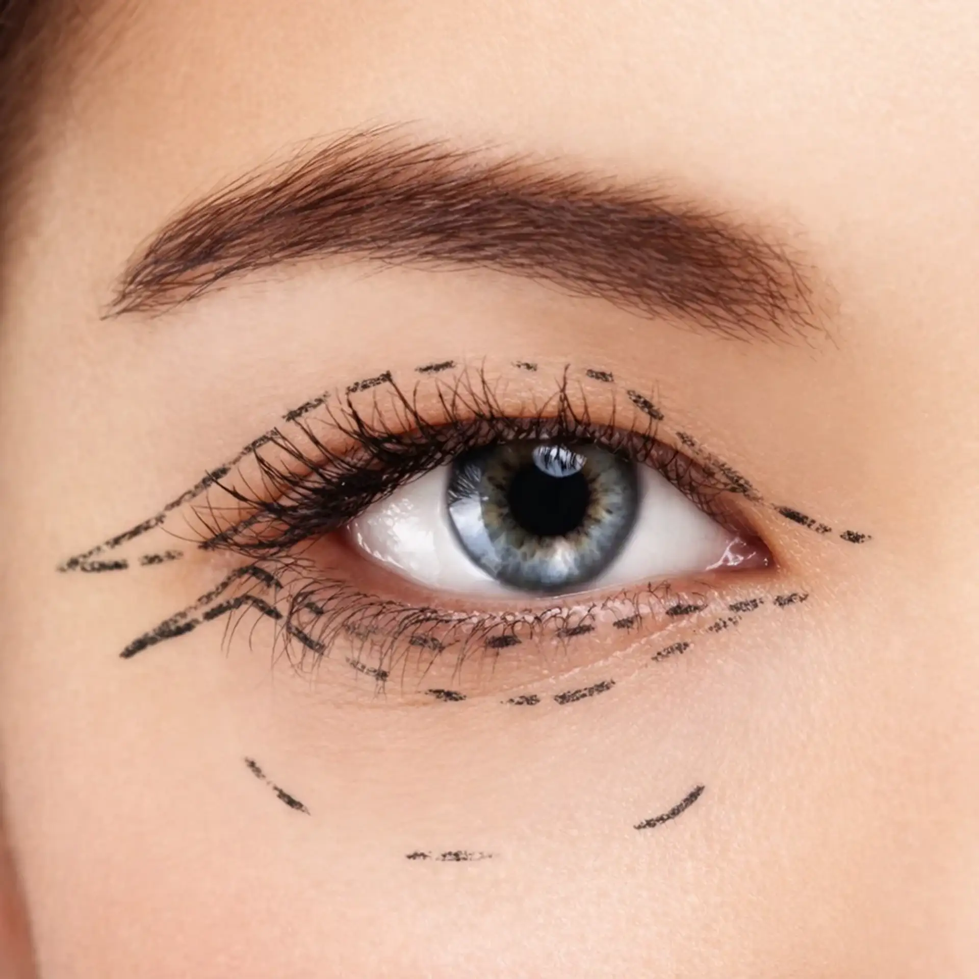 under-eye-stem-cell