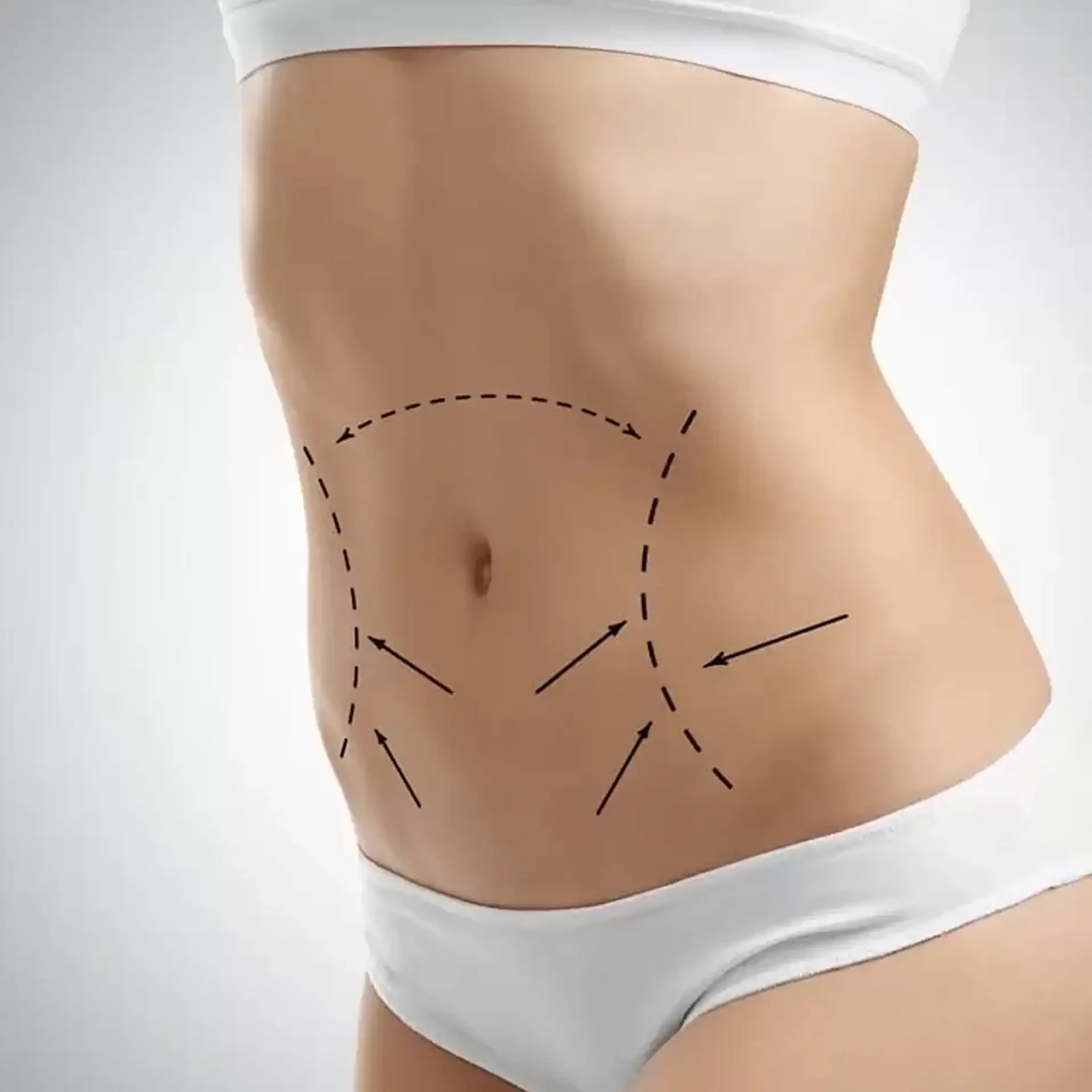 Total Body Reshaping