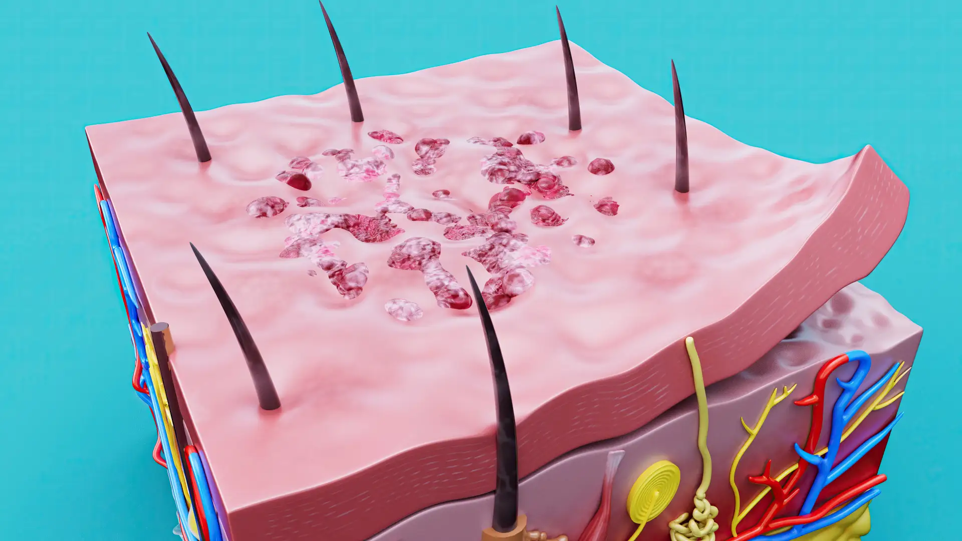 scar-and-tissue-regeneration-treatment