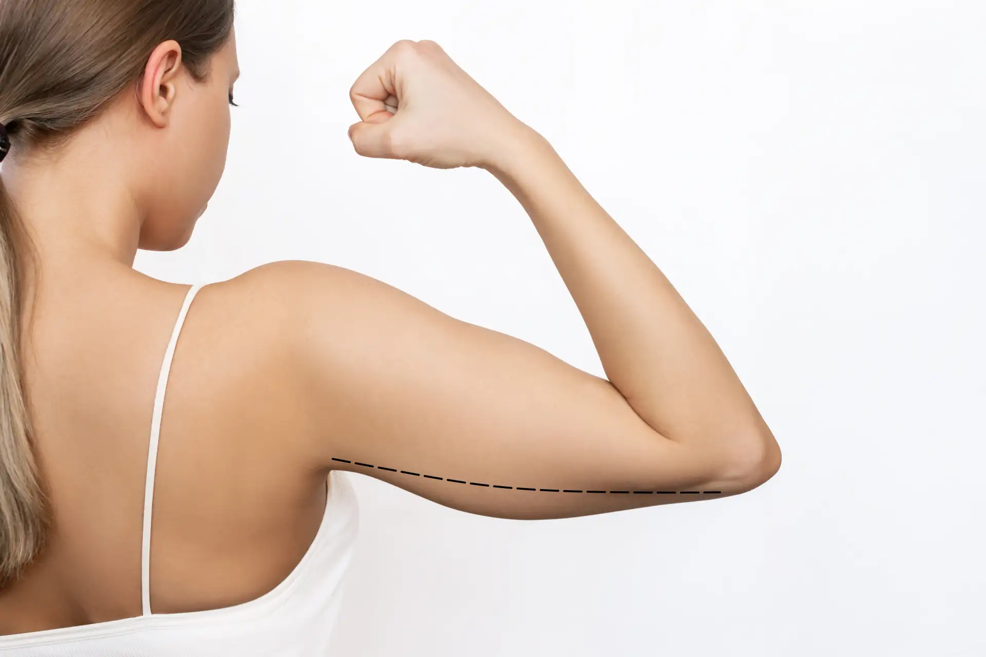 Arm Lifting