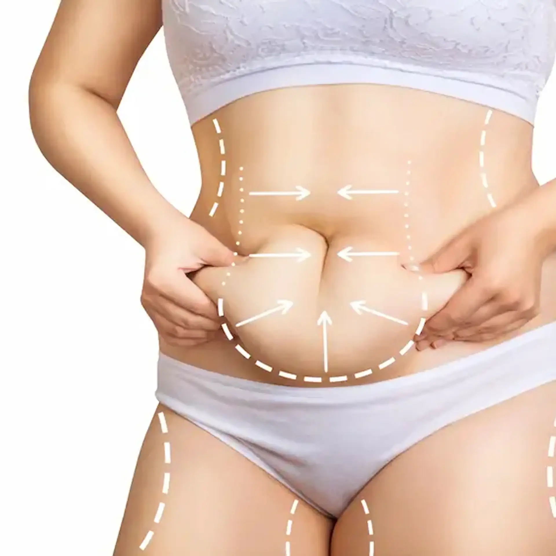 candidate-abdominoplasty
