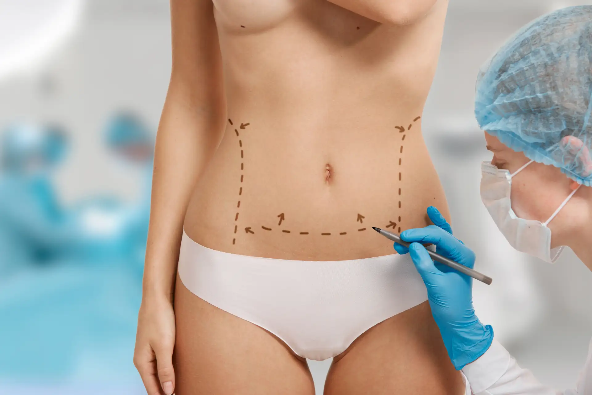 what-is-liposuction?