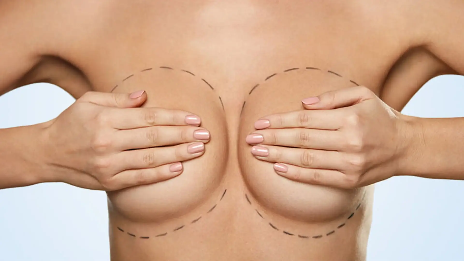 what-is-breast-reduction