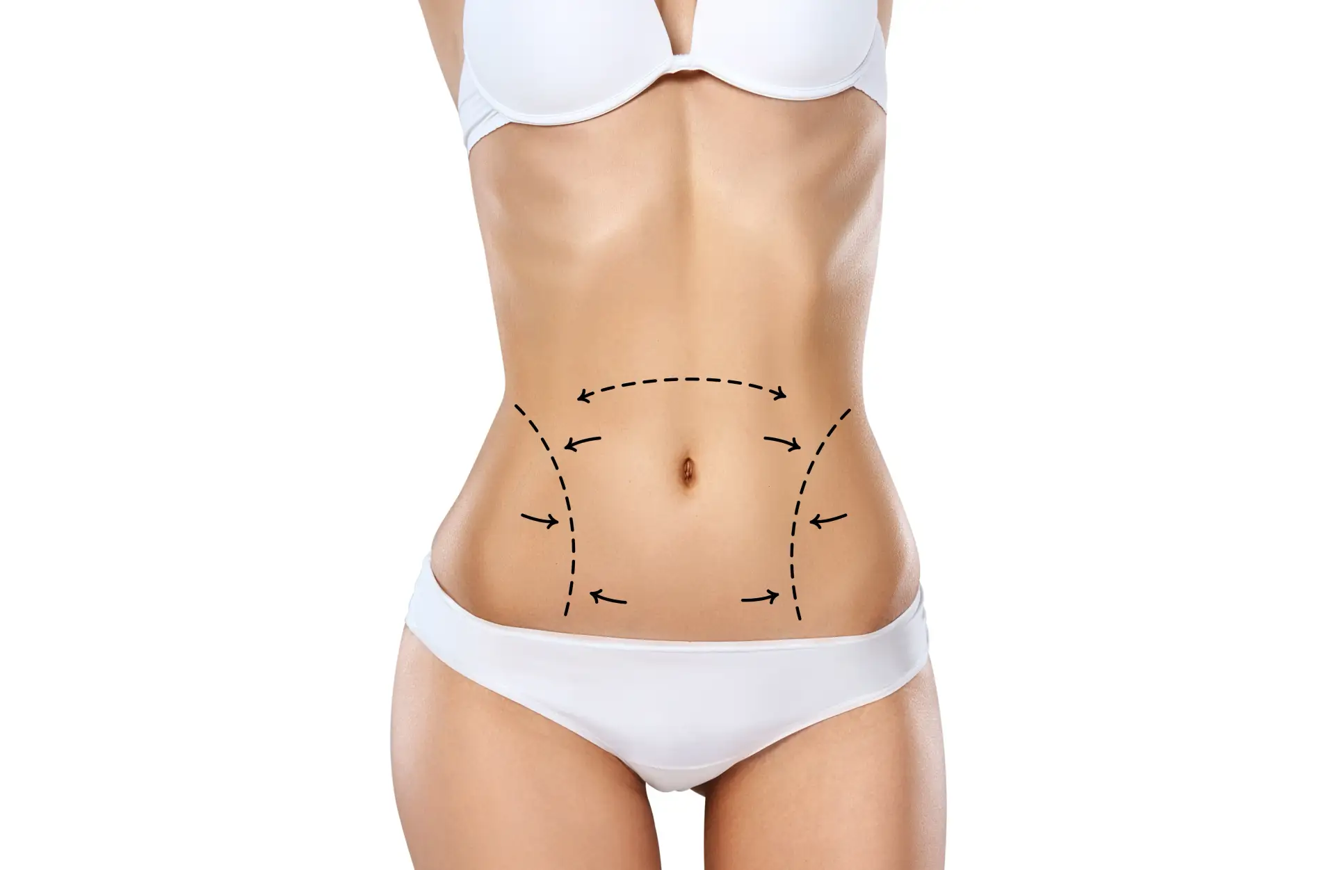 woman-liposuction