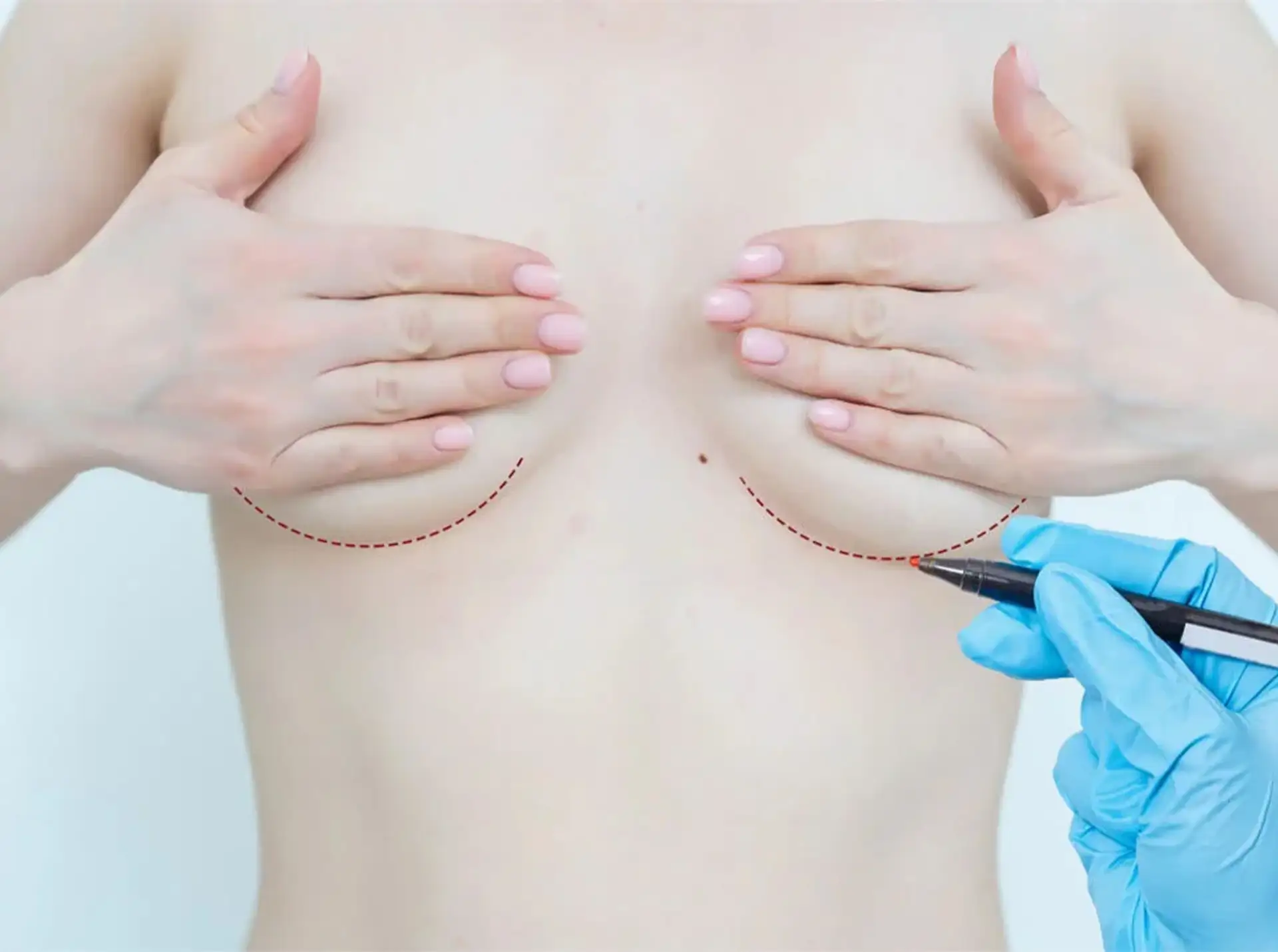 benefits-breast-reduction