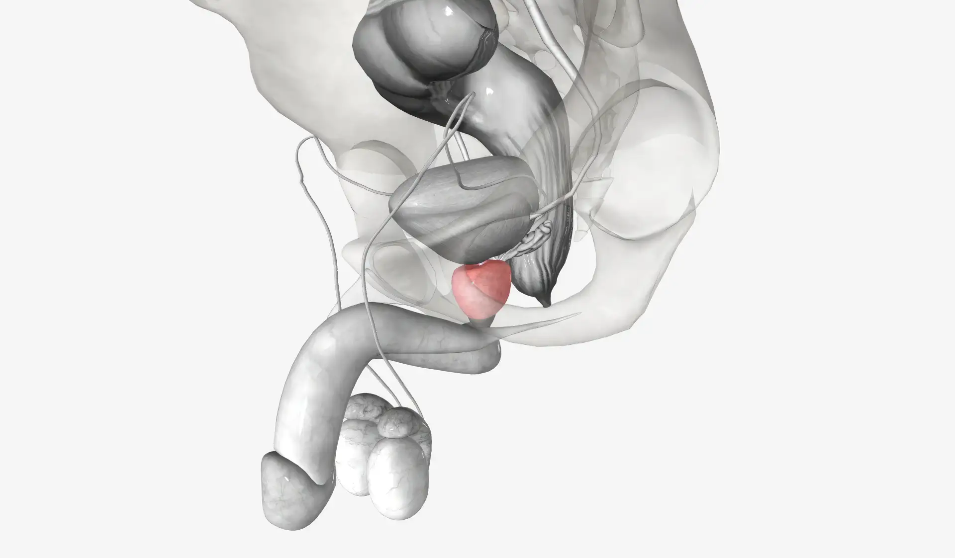Scrotal Reconstruction