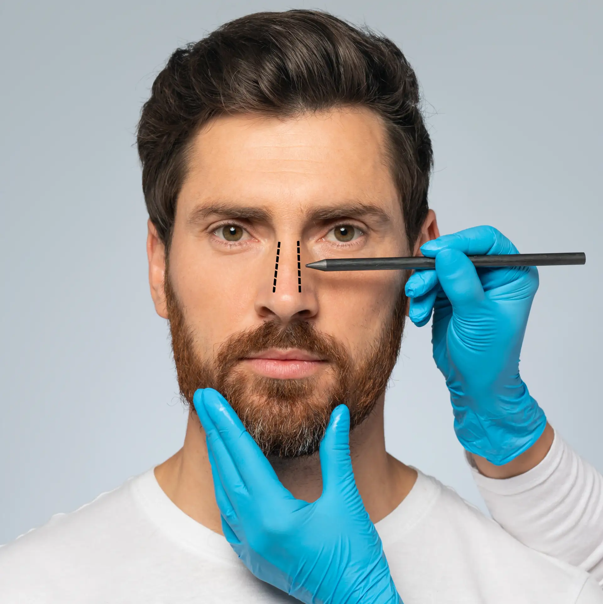 male-rhinoplasty
