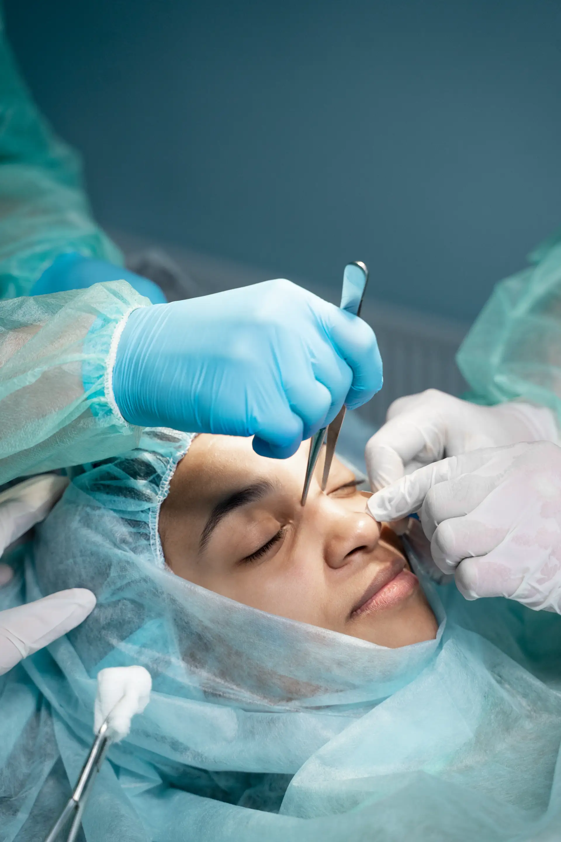 Rhinoplasty
