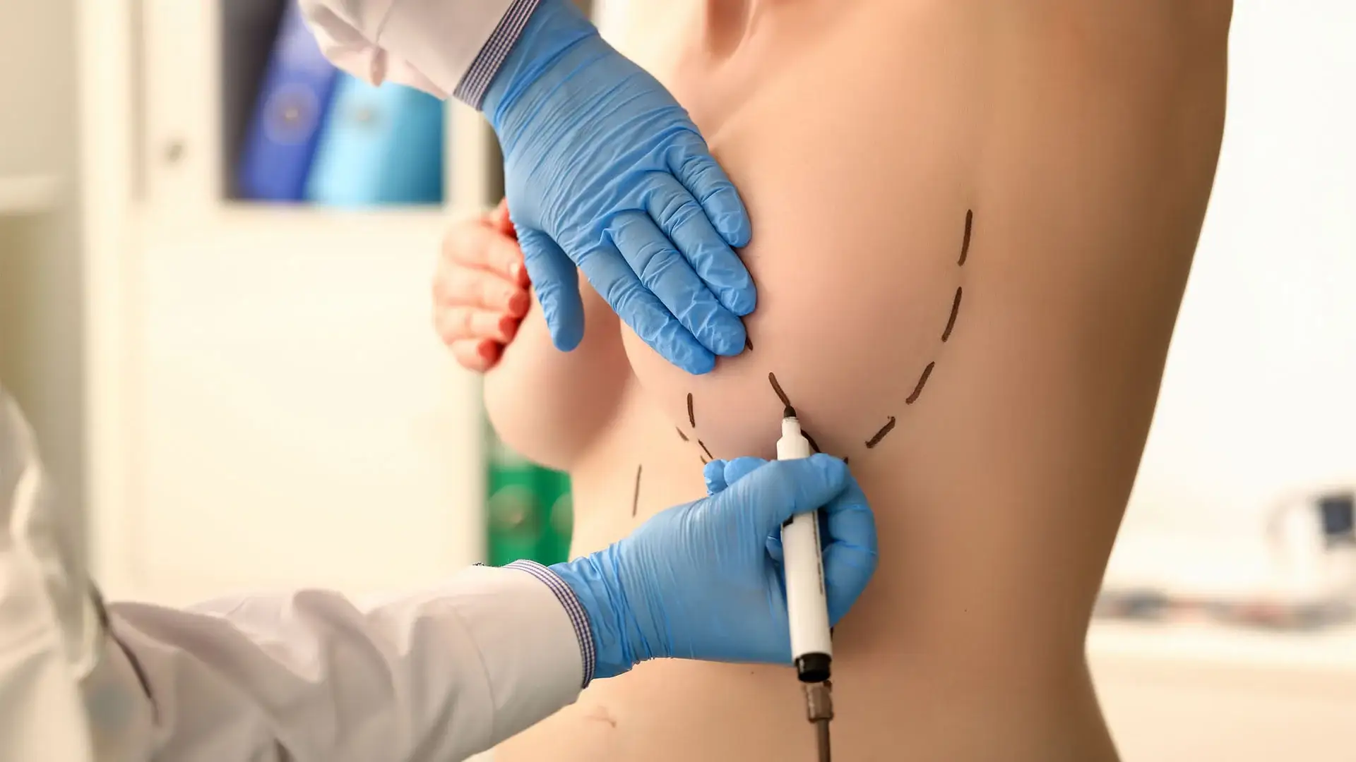 breast-reduction