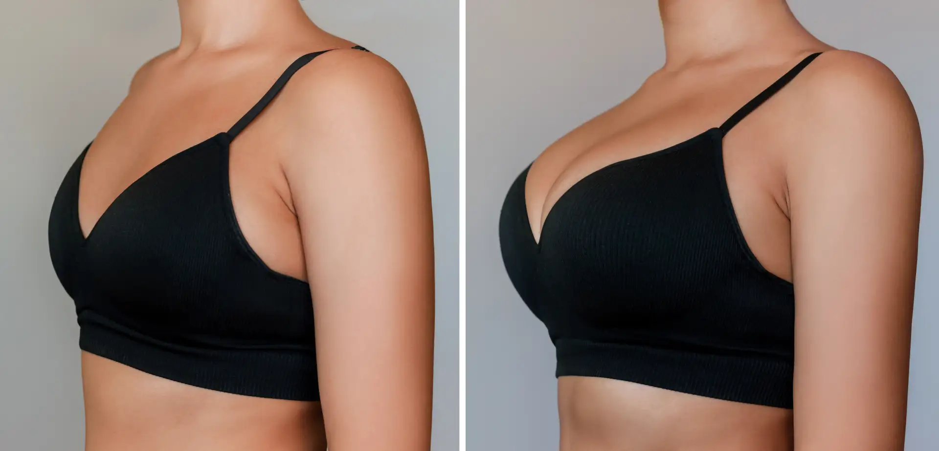breast-lifting