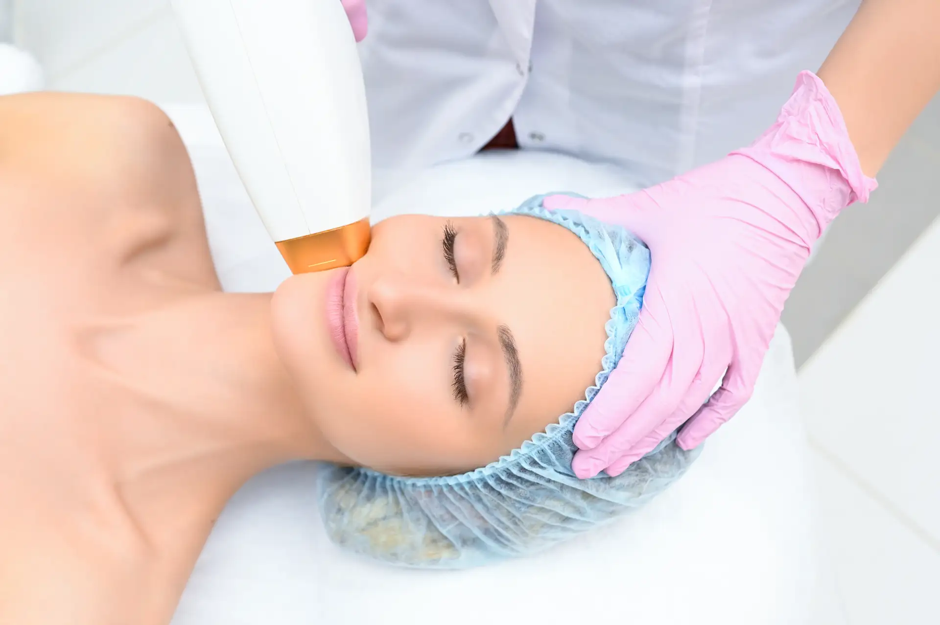fractional-laser