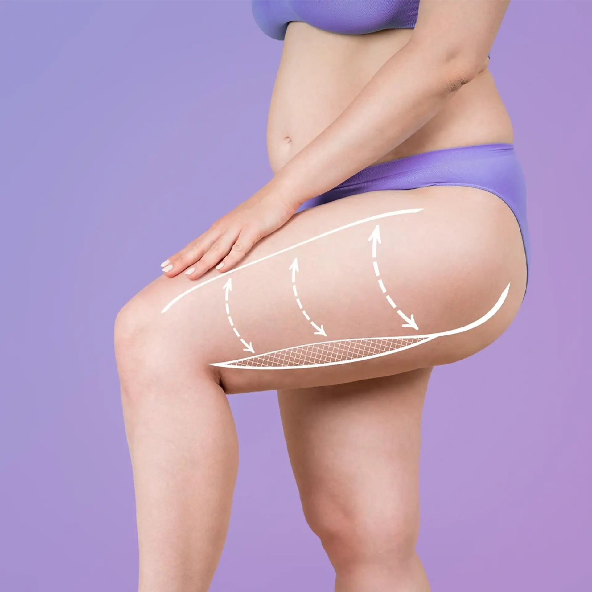 benefits-thigh-lift