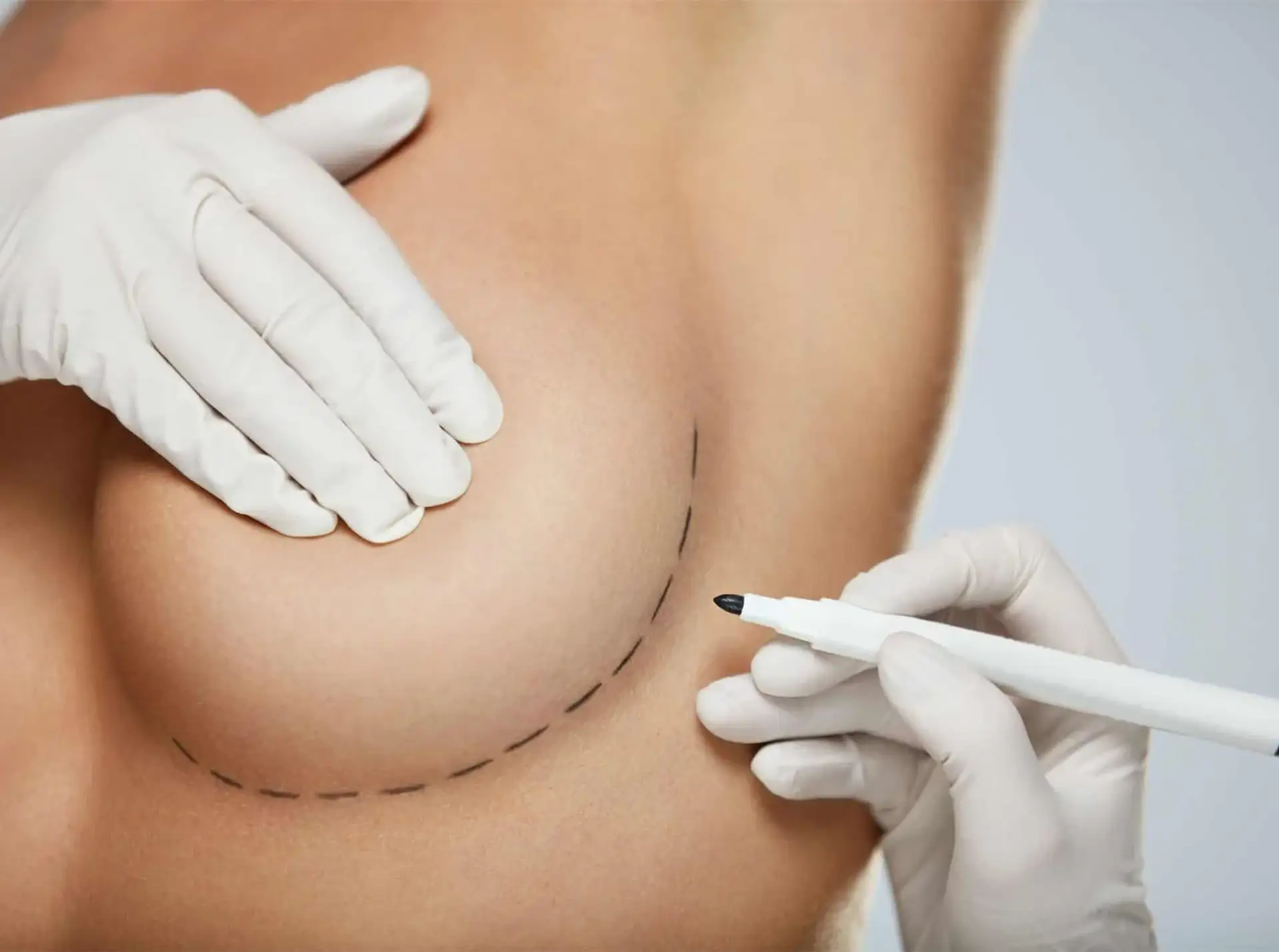 breast-reduction-prices