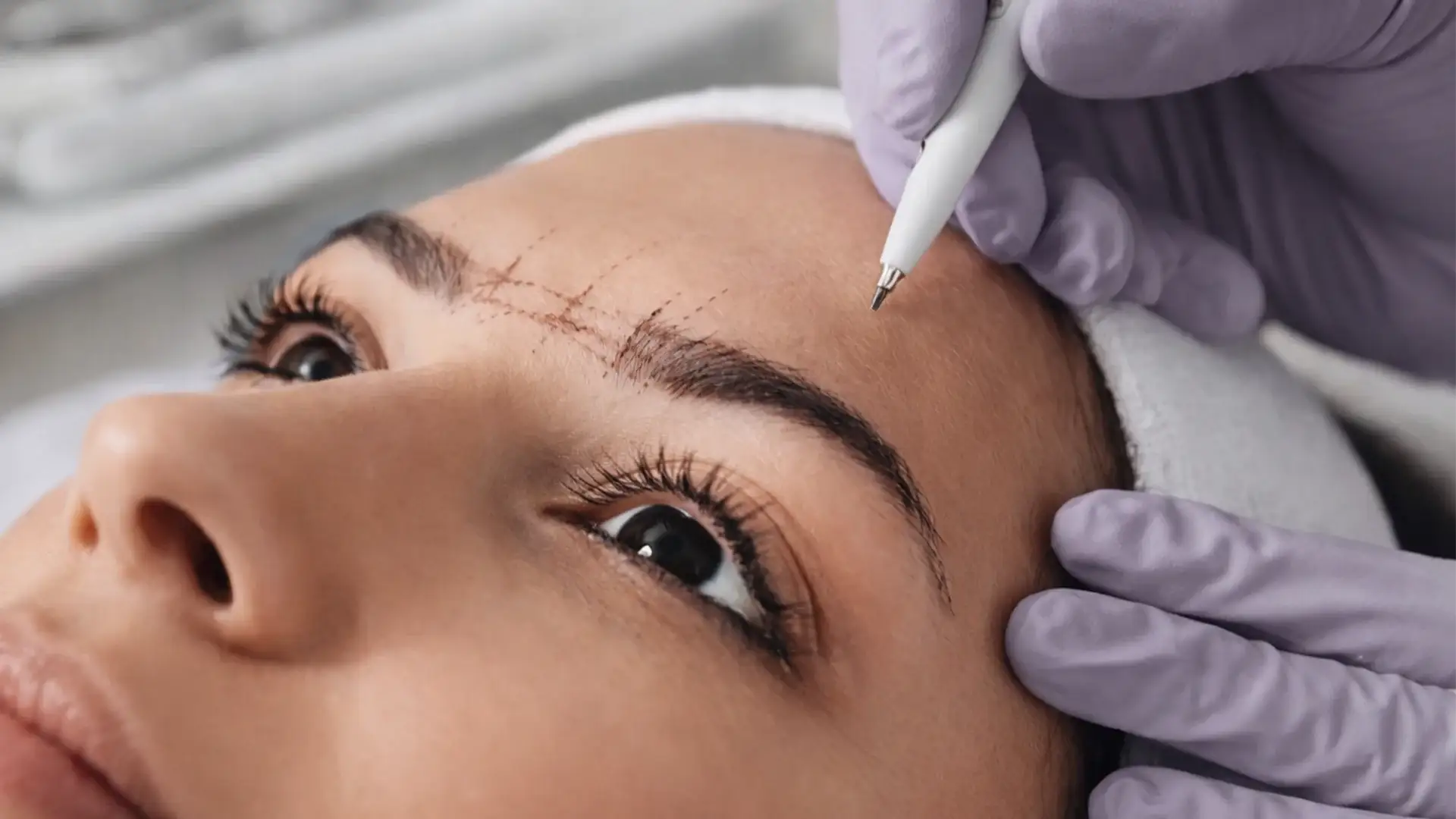what-is-brow-lift