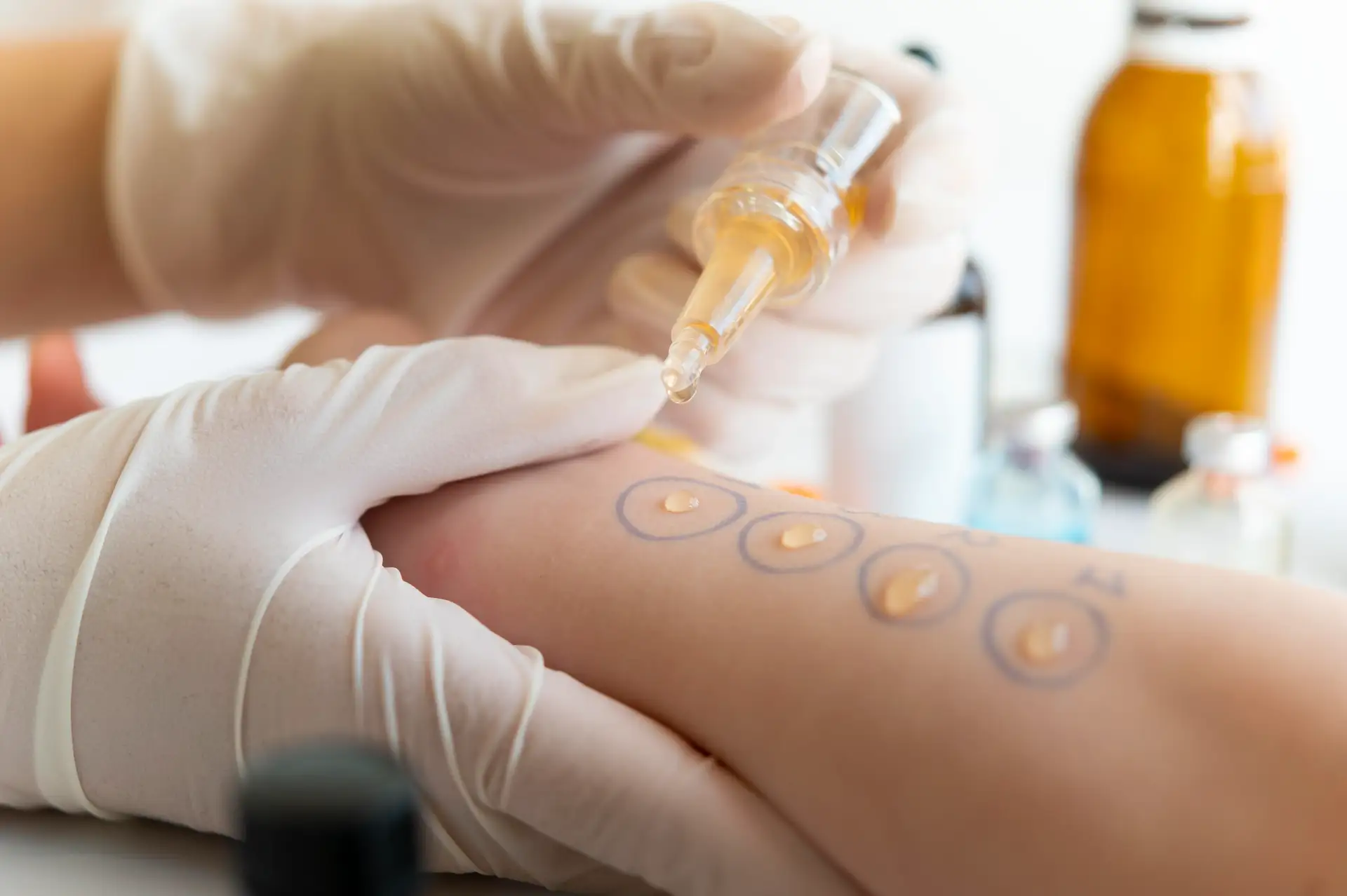 skin-genetic-testing