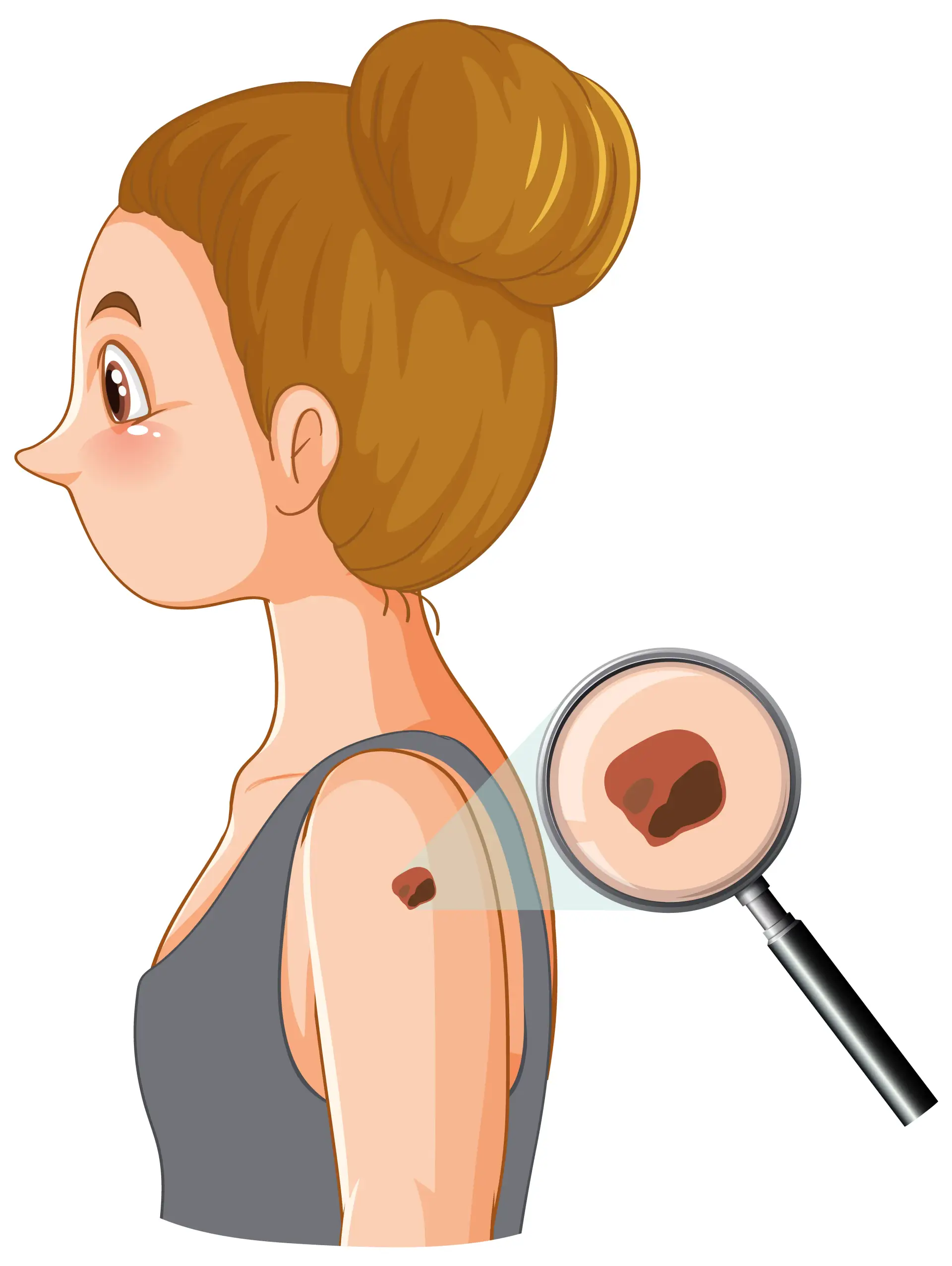 what-is-mole-removal