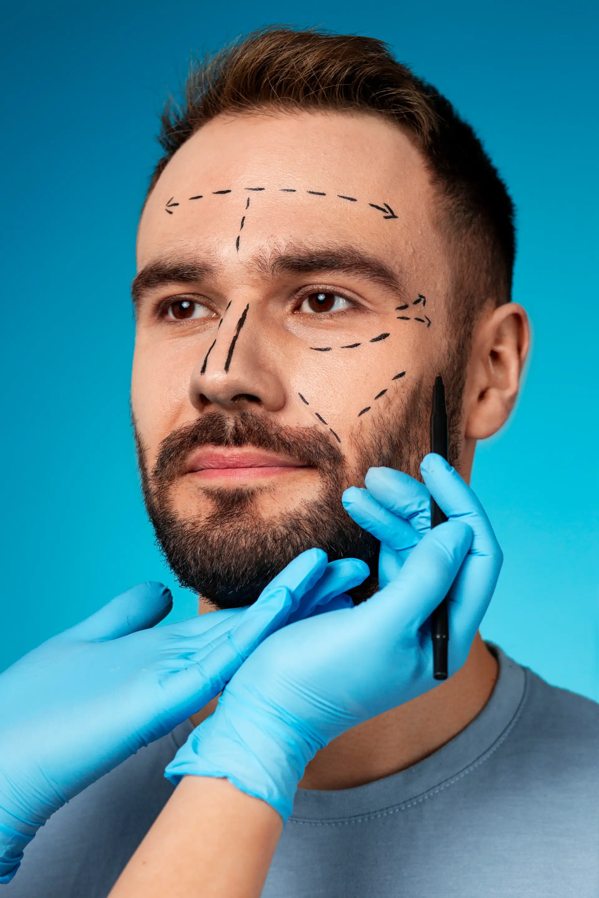 men-choose-rhinoplasty