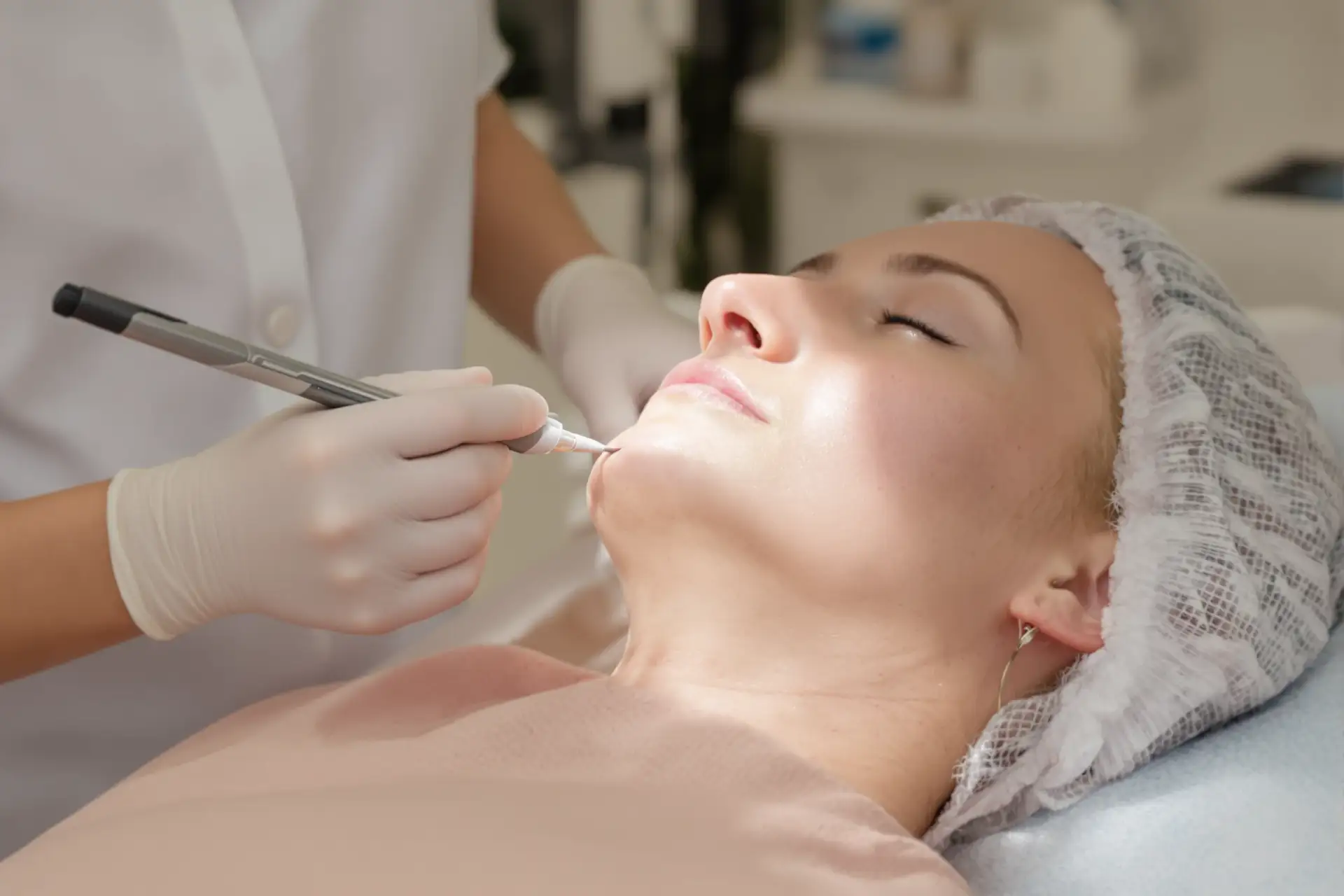 Mole Removal: Methods and Aftercare